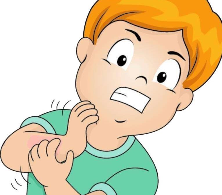 Psoriasis infantil. De la sobreprotección a la naturalidad.