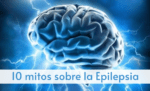 Encéfalo que representa carga eléctrica por la Epilepsia