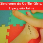 Síndrome de Coffin-Siris. El pequeño Jaime